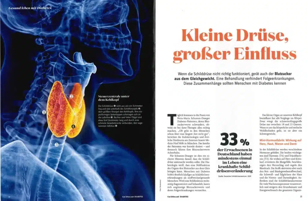 Deutsches Schilddruesenzentrum, Aktuelles Fachartikel Gut Leben mit Diabetes